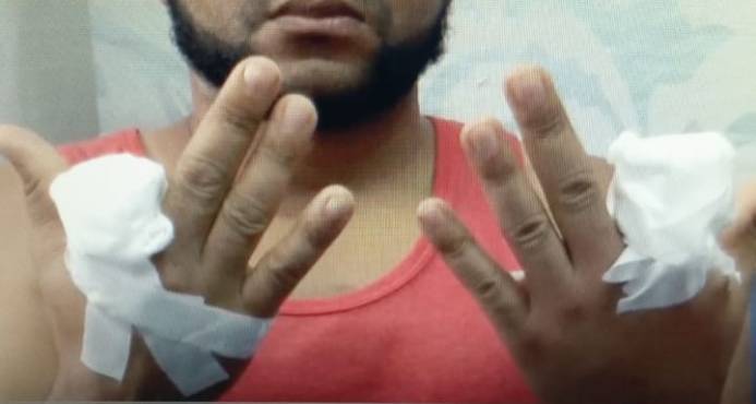Narcos cortan con un machete dedos de las manos de un joven