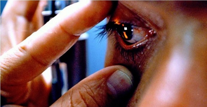 Los ojos, una ventana para detectar enfermedades