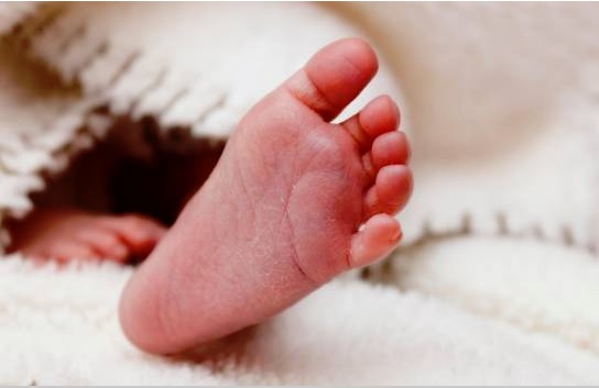 Padres de siamesas decidieron tener las criaturas a pesar de conocer malformaciones