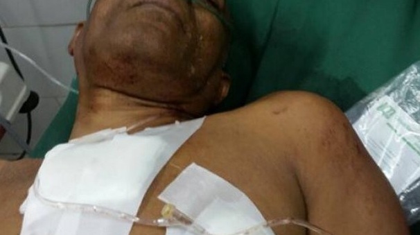 EN MAO, hieren vigilante de envasadora de gas y cargan con dinero